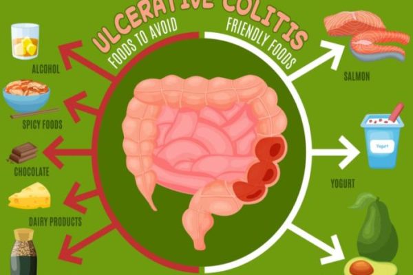 Colitis ulcerosa kinder ernährung