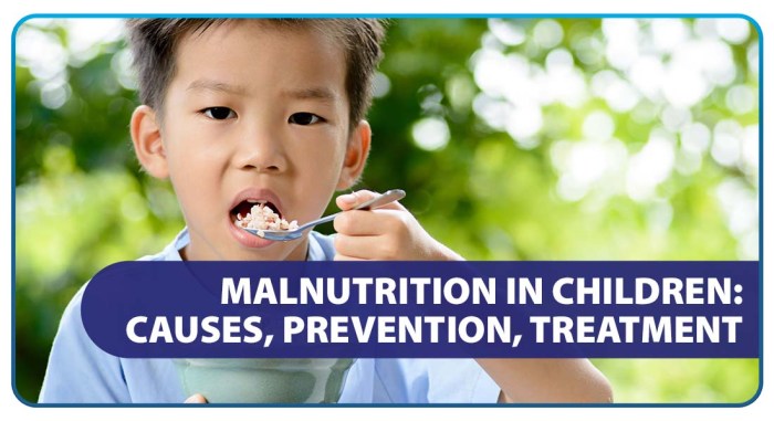 Malnutrition child acute sa faces kulang timbang removing stigma emergency invisible especially